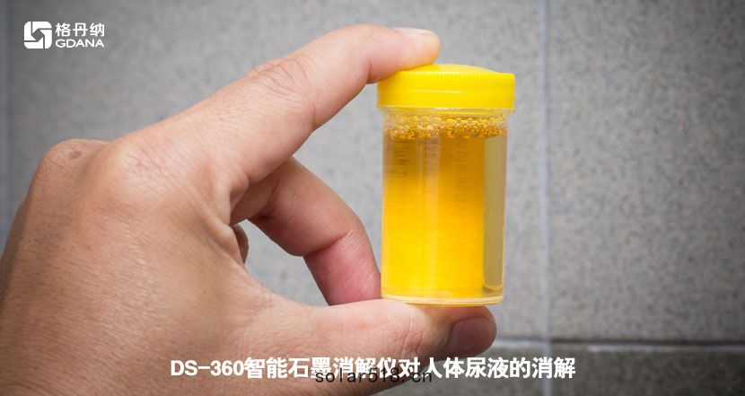 DS-360智能石墨消(xiāo)解儀對人體(tǐ)尿液的消解(jiě)
